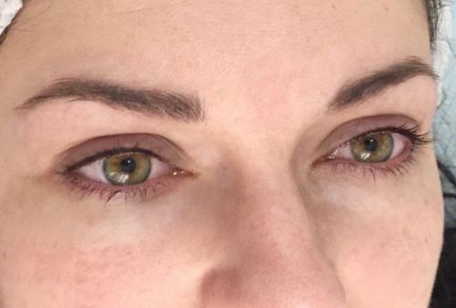 Микроблейдинг века. Микроблейдинг межресничного пространства, фото