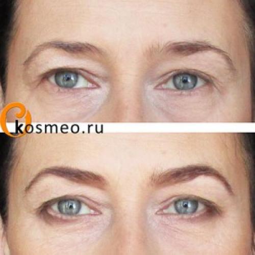 Лифтинг-макияж-нависшее веко. Возрастной макияж: лифтинг-эффект с помощью косметики