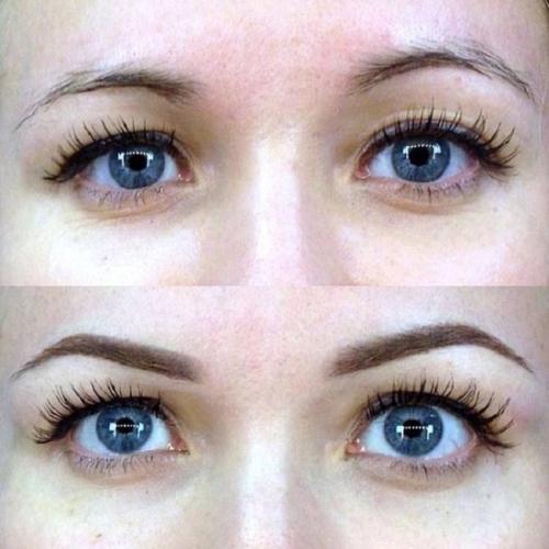 Асимметрия бровей это. Причины асимметрии