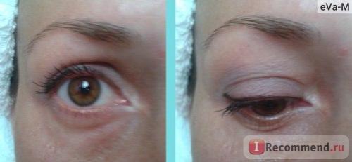 Форум уход за собой после 30 лет. Быть красивой - долг каждой женщины. Как сохранить молодость после