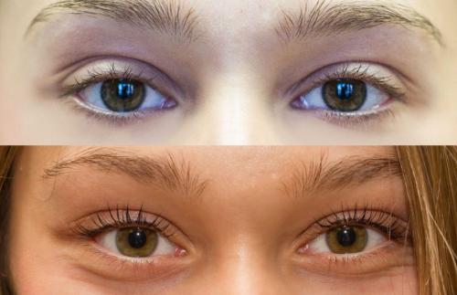 Ботокс 3д для ресниц. Модный ботокс ресниц: что это дает визуально?