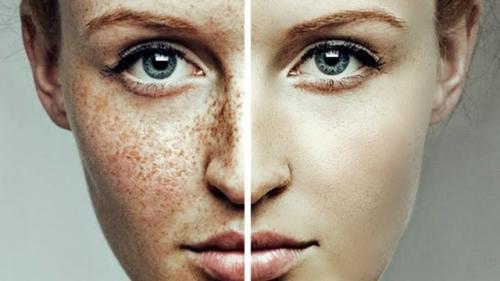 Отбеливающие маски для лица от пигментных пятен. Показания и противопоказания