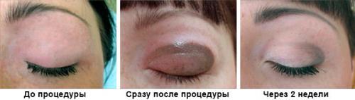 Татуаж глаз посл. Что такое татуаж век