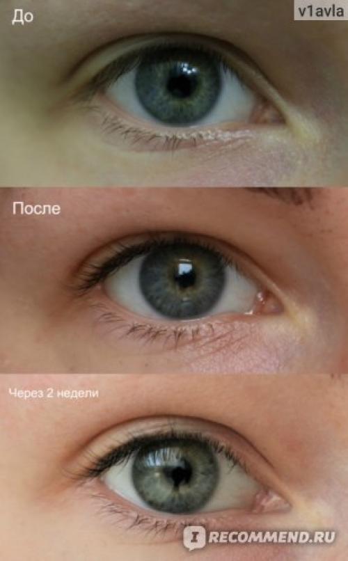 Через какое время можно наращивать ресницы после ламинирования. Ламинирование или наращивание ресниц: сравнение процедур и что лучше