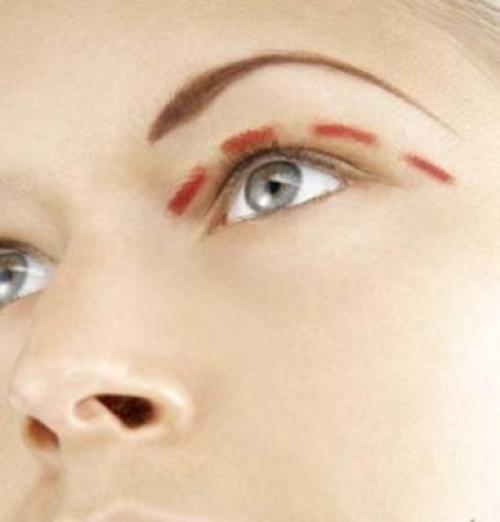 Как сделать, чтобы появились веки. Совет 1: Как подтянуть кожу вокруг глаз