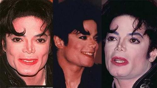 Какого цвета были глаза у майкла Джексона. Более 10 сложных операций: как менялось лицо Майкла Джексона на протяжении всей жизни