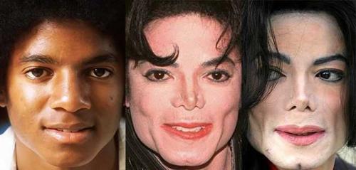 Какого цвета были глаза у майкла Джексона. Более 10 сложных операций: как менялось лицо Майкла Джексона на протяжении всей жизни
