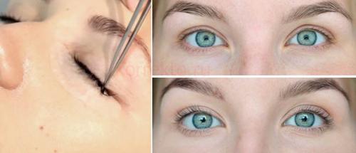 Ошибки при ламинировании ресниц. Технология ламинирования ресниц