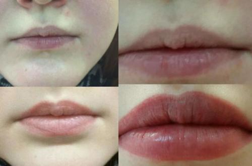 Как проводится процедура акварельного татуажа губ и ее преимущества