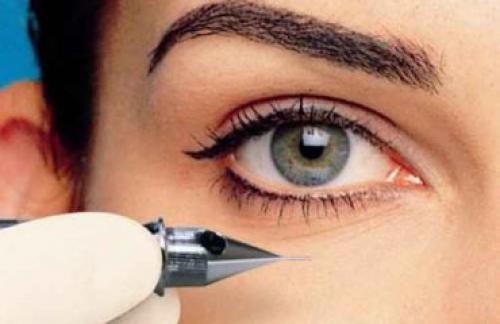 Кто пил алкоголь после татуажа. 