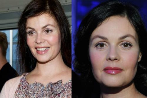 Екатерина Андреева — делала ли телеведущая пластику?