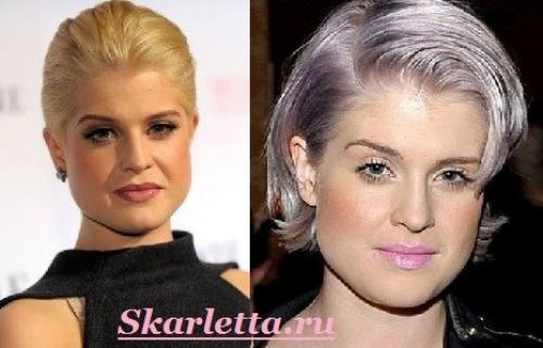 V образная форма лица. 