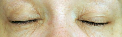 Пластырь для макияжа. Отзыв. Моментальная и невидимая подтяжка век без операции при помощи пластырей MAGICSTRIPES by Natalie Franz