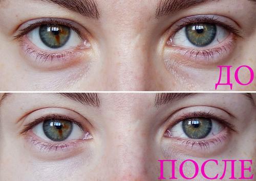 Пластырь для макияжа. Отзыв. Моментальная и невидимая подтяжка век без операции при помощи пластырей MAGICSTRIPES by Natalie Franz