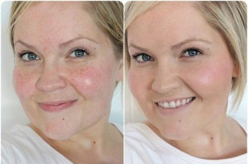 Как сделать идеальный тон лица без косметики. 