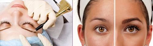 Плюсы и минусы татуажа бровей. В чем опасность татуажа бровей, какие плюсы и минусы он имеет? 12