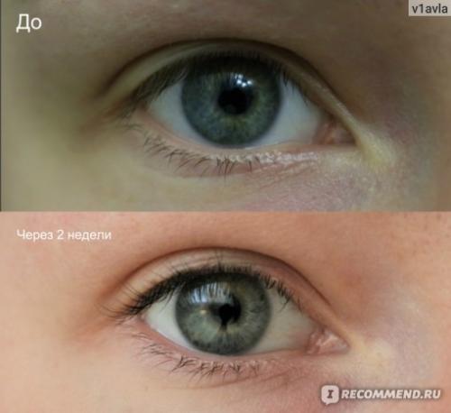 Можно ли после ламинирования наращивать ресницы. Ламинирование или наращивание ресниц: сравнение процедур и что лучше