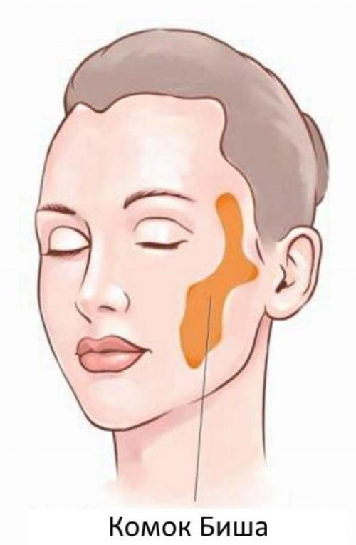 Звезды, удалившие комки Биша: стоила ли игра свеч? (21 фото) 02 Звезды, удалившие комки Биша: стоила ли игра свеч? (21 фото) 02