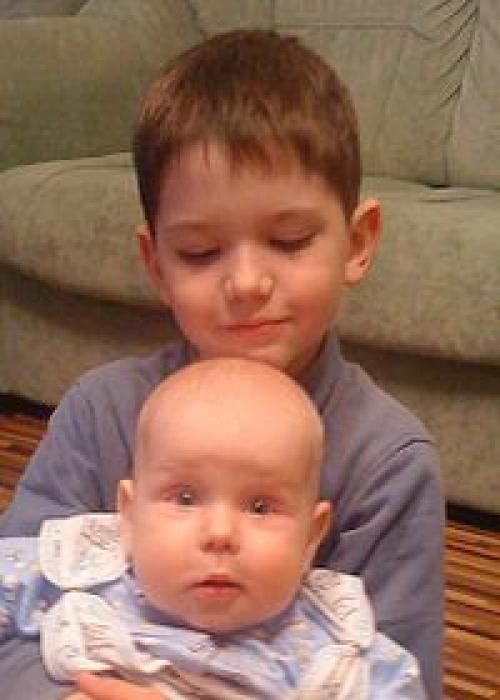 Звезды, удалившие комки Биша: стоила ли игра свеч? (21 фото) 01 Звезды, удалившие комки Биша: стоила ли игра свеч? (21 фото) 01