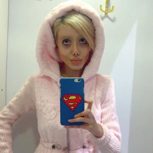 Превращение в Анджелину Джоли. Иранка горела желанием превратиться в Анджелину Джоли (17 фото)