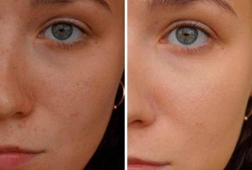 Некомедогенная база под макияж. Лучшие основы под макияж, которые пробовала: некомедогенны, минимум вредных силиконов