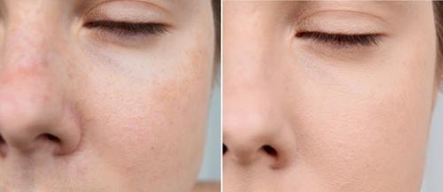 Тональный крем балет вреден. Крем «Балет»