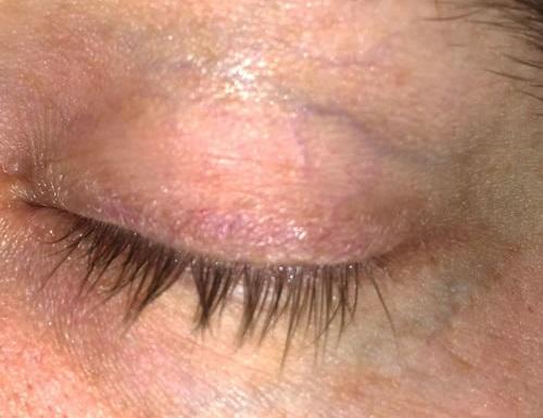 Веки становятся жирными. Косметика для жирной кожи век