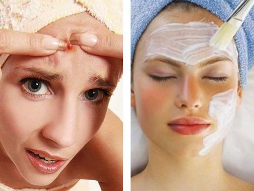 Маска от прыщей своими руками. Как сделать маску для лица от прыщей