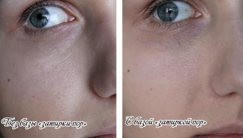 Чем заменить затирку для пор. Бальзам-затирка пор от TonyMoly и сказ о негативных отзывах