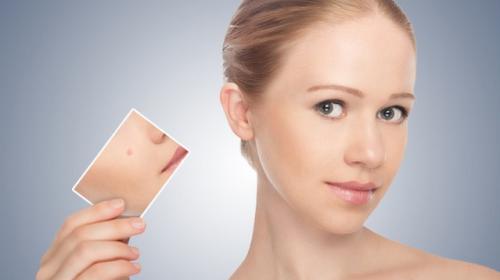 Как замазать прыщи, чтобы не было видно. Как замазать прыщи с помощью косметики 03 Как замазать прыщи, чтобы не было видно. Как замазать прыщи с помощью косметики 03