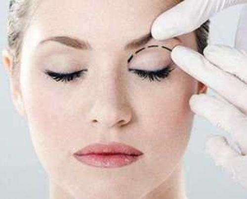 Нависшее и не нависшее веко. 6 способов избавится от нависшего века в домашних условиях 21 Нависшее и не нависшее веко. 6 способов избавится от нависшего века в домашних условиях 21