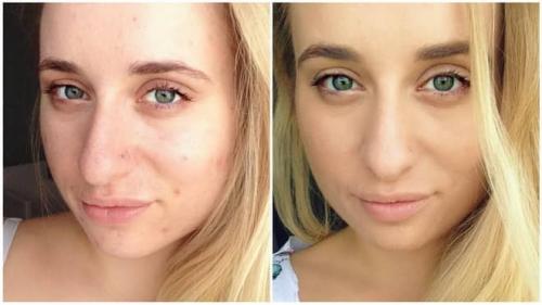 Тональный крем балет вреден. Тональный крем «Балет» – мнение потребителей и отзывы косметологов