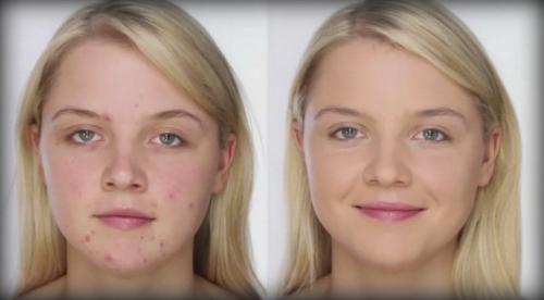 Как тональным кремом замазать прыщи на лице тональным кремом. Тональный крем 02