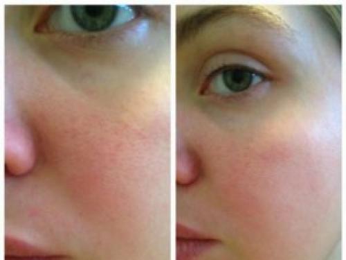 Праймер мейбелин. Праймер Baby Skin от Maybelline