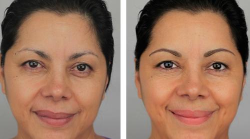 Перманентный макияж тени на верхних веках. Перманентный макияж и его основные виды 18 Перманентный макияж тени на верхних веках. Перманентный макияж и его основные виды 18