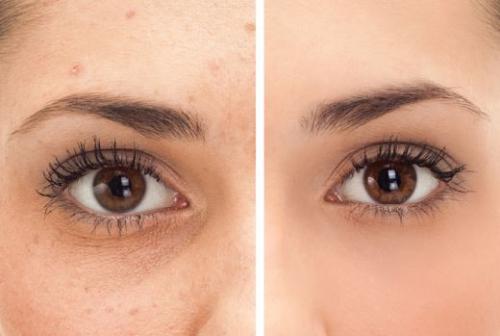 Как выровнять тон лица косметикой. Тон лица –, как выровнять в домашних условиях