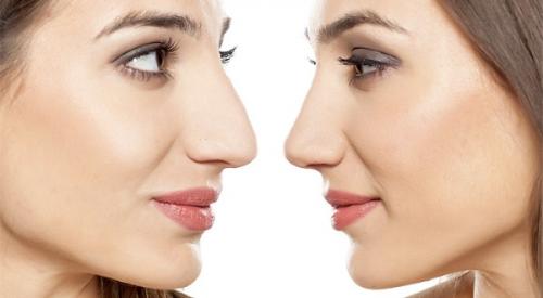 Пластические операции лица до и после. Показания к пластической операции