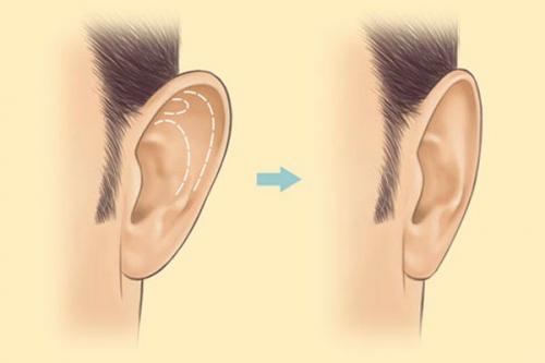 Пластические операции лица до и после. Показания к пластической операции