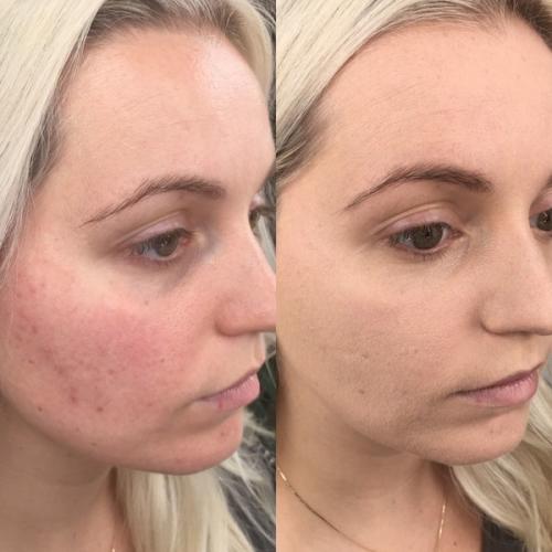 Макияж на свадьбу самой себе. Как сделать свадебный макияж своими руками? Кисточки, краски и карандаши