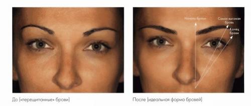 Низкие брови. Коррекция бровей. Идеальные брови. Уход за бровями.