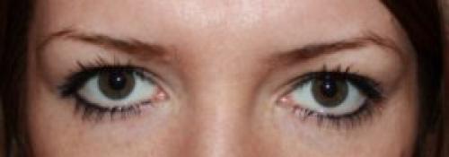 Тени скатываются даже с базой. Причины скатывания теней