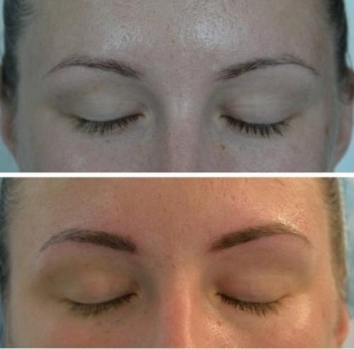 Как влияет касторовое масло на брови. Отзывы о применении касторового масла для ресниц и бровей