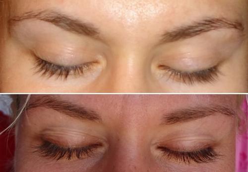 Как влияет касторовое масло на брови. Отзывы о применении касторового масла для ресниц и бровей