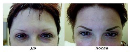 Как делается микропигментирование бровей. Что такое микропигментирование бровей