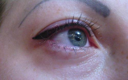 Татуаж глаз нависшее веко. Что нужно знать о микропигментировании глаз