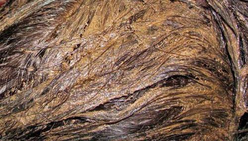 Дегтярное мыло для волос от вшей. Эффективно ли дегтярное мыло против педикулеза?