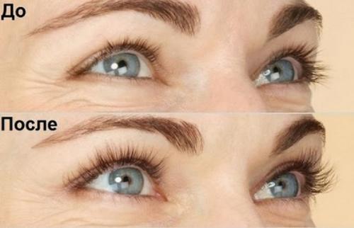Касторовое масло или репейное масло для ресниц. Касторовое или репейное масло: какое лучше для укрепления ресниц и бровей 04
