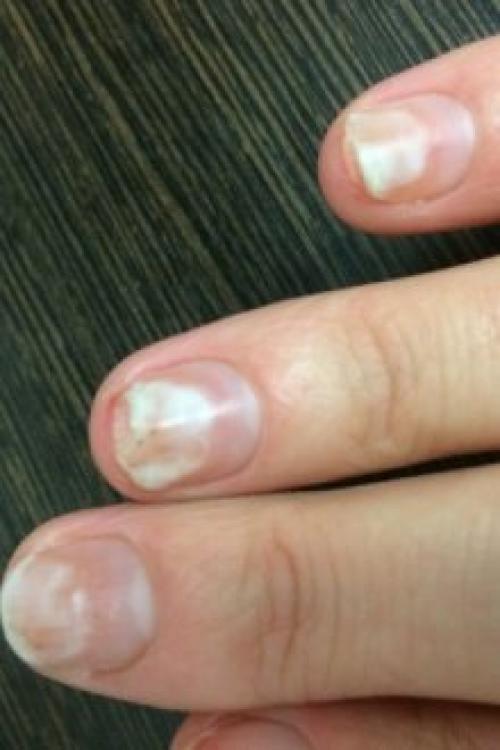 Почему не держится гель. Почему отслаивается гель-лак от ногтей: причины и особенности