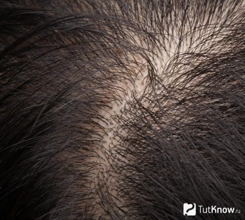 Маска для волос от жирности у корней в домашних условиях. Маски для жирных волос в домашних условиях рецепты 05