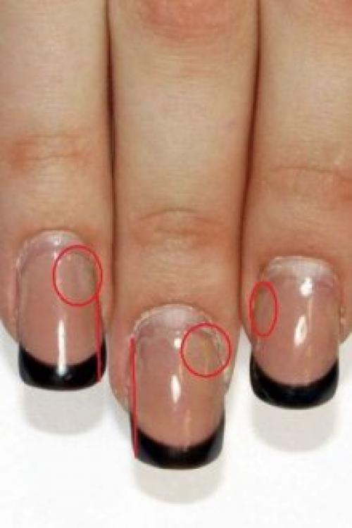 Почему не держится гель. Почему отслаивается гель-лак от ногтей: причины и особенности